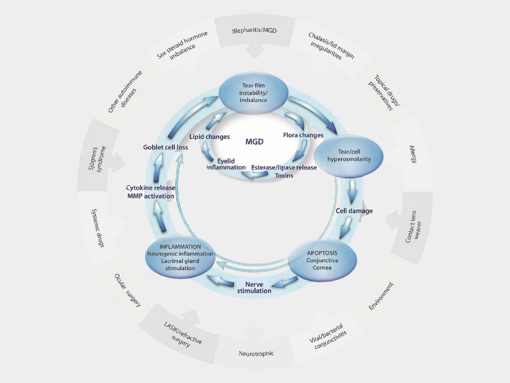 Double vicious cycle of Dry Eye inflammation with risk factors.